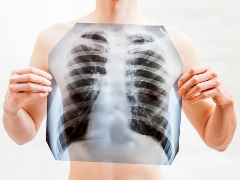 Locandina Spirometria