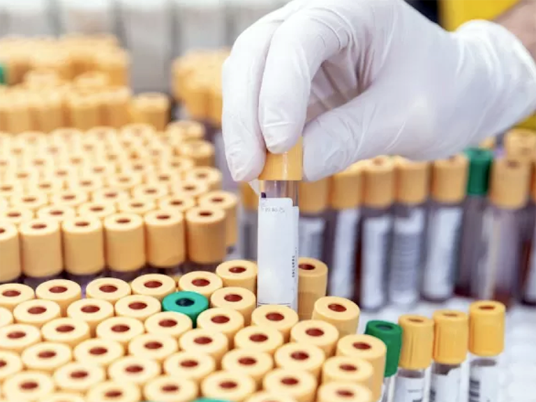 Laboratorio Analisi